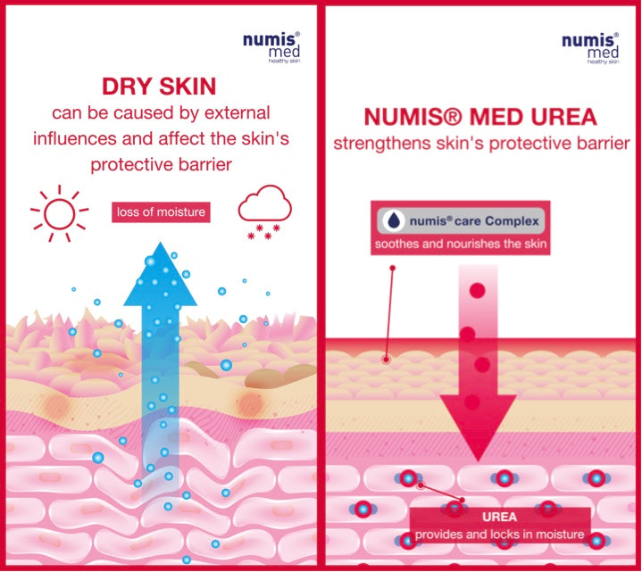 NUMIS® MED Every Day Shampoo UREA 5%